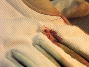 Punctured-Glove Punctured glove